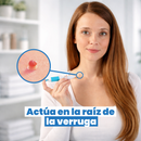 DermaClear™ – Removedor de verrugas